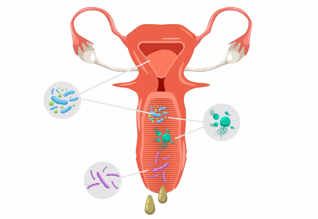 Recognizing the Symptoms of Bacterial Vaginosis: What Every Woman Should Know